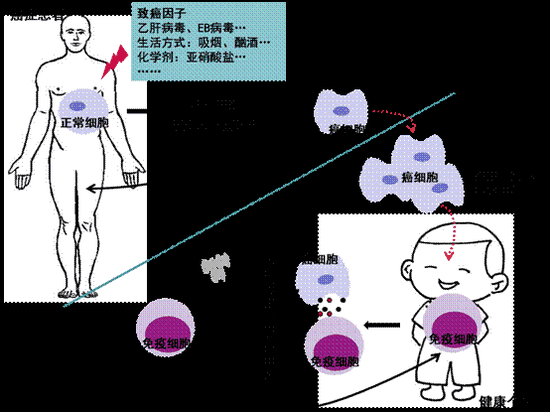癌症到底会传染吗?每个人体内都有原癌基因 癌症到底会传染吗?每个人体内都有原癌基因
