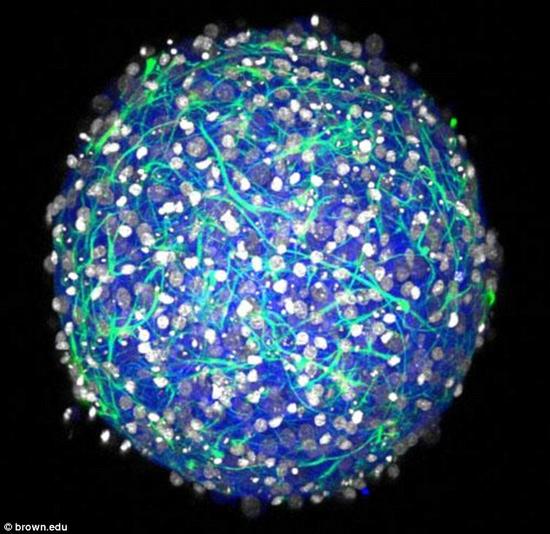 科学家研发迷你大脑模型:可用于药物测试 科学家研发迷你大脑模型:可用于药物测试