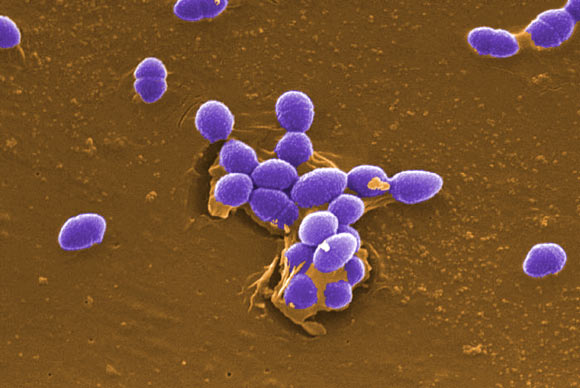 ͼֲɫķ೦(Enterococcus faecalis)