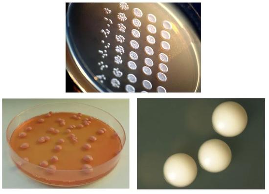 ĸǡ֮ĸָĸSaccharomycotinaĸΪıơơƽĸSaccharomyces cerevisiae󣩣ƴȥζľĸBrettanomyces spp.£Լ༲ڴİɫCandida albicans£ | Wikimedia Commons, Rainis Venta, CC BY-SA 3.0 / https://creativecommons.org/licenses/by-sa/3.0 & Wikimedia Commons, Bojan Žunar, CC BY-SA 4.0 / https://creativecommons.org/licenses/by-sa/4.0 